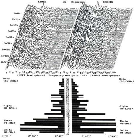 Brain Research Tachyon